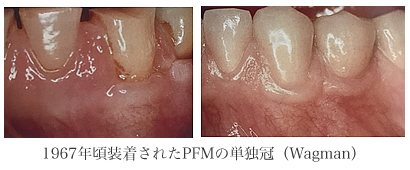 桑田先生がDr.Wagmanと治療されたケース