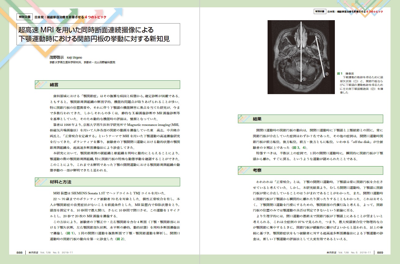 超高速MRIを用いた同時断面連続撮像による下顎運動時における関節円板の挙動に対する新知見