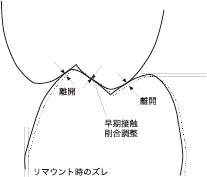 オクルージョンの半世紀 KUWATA COLLEGE 25周年記念 | 桑田正博 公式サイト